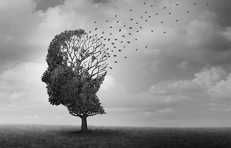 An illustrative image of Alzheimer’s disease and dementia, memory loss and brain degeneration (wildpixel; iStock by Getty Images)